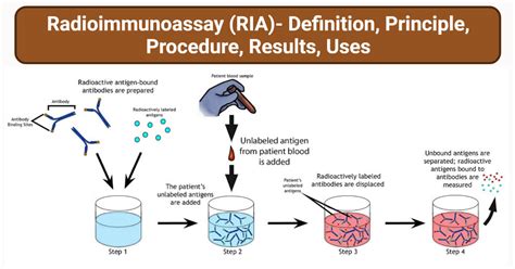 asian hospital lab results|RIA Laboratory Test .